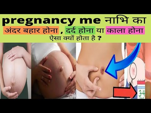 प्रेगनेंसी में नाभि बाहर या अंदर होना क्या संकेत करता है - Naval during Pregnancy