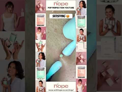 Wow! #pimple #pimples #pimplepopping #shortsfeed #shortvideo #shorts #short #youtubeshorts #youtube