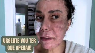 DRAMA DA CIRURGIA DE VESÍCULA 😱 + MINHAS COMPRINHAS E PRESENTES DA ANNE 💎 | Pós-Laser CO2