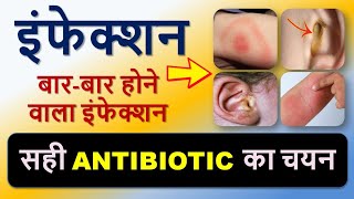 बार-बार इंफेक्शन का इलाज और सही Antibiotic का चयन