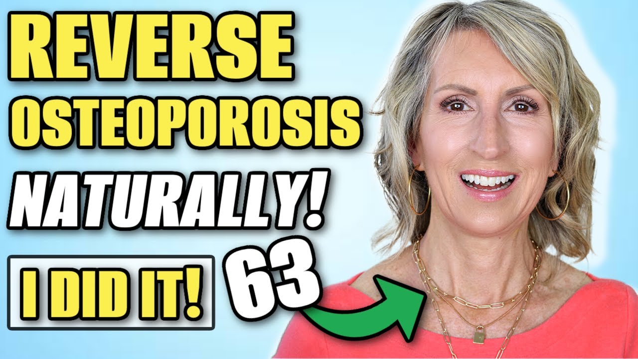Top 4 Natural Remedies to Reverse Osteoporosis! (These Worked for Me)