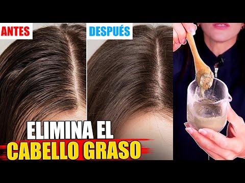 ¡ACABA con el CABELLO GRASO! Receta Casera Fácil y Rápida