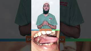 Mouth कैंसर Beyond Tobacco : Hidden Risk Factors