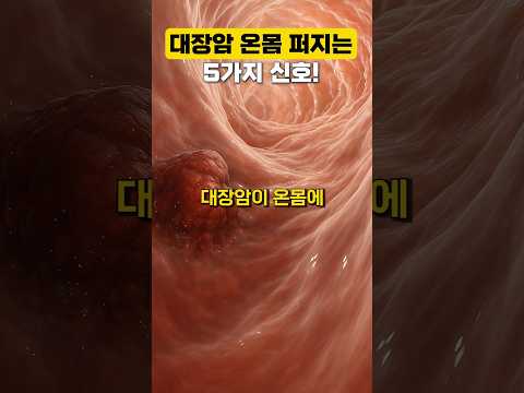 대장암 온몸에 퍼진다는 충격적 증상 5가지! #건강 #건강관리