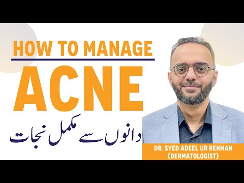 Pimple Aur Dane Kaise Hatayen - Acne Kyu Hota Hai - Pimple Causes & Treatment - How To Manage ACNE?