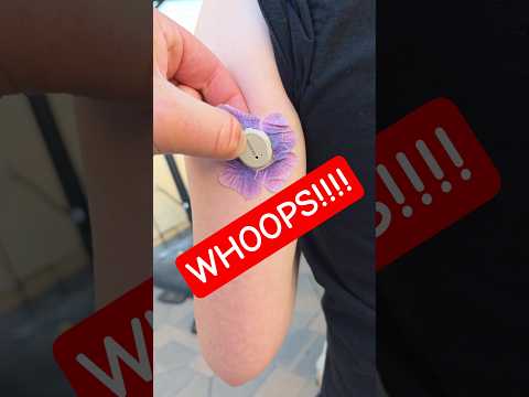 Whoops! Dexcom Change #diabetes #t1d #type1diabetes #dexcom #diabetestype1