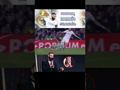 เผยสาเหตุที่ คาริม เบนเซม่า ต้องพันผ้าไว้ที่มือ (why benzema hand taped) #realmadrid #benzema