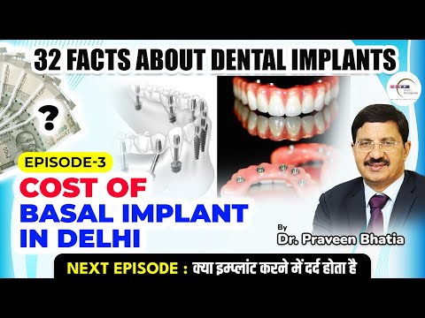 Basal Implant ki Cost kitni hoti hai? Dr. Praveen Bhatia #basalimplants #implants #teeth