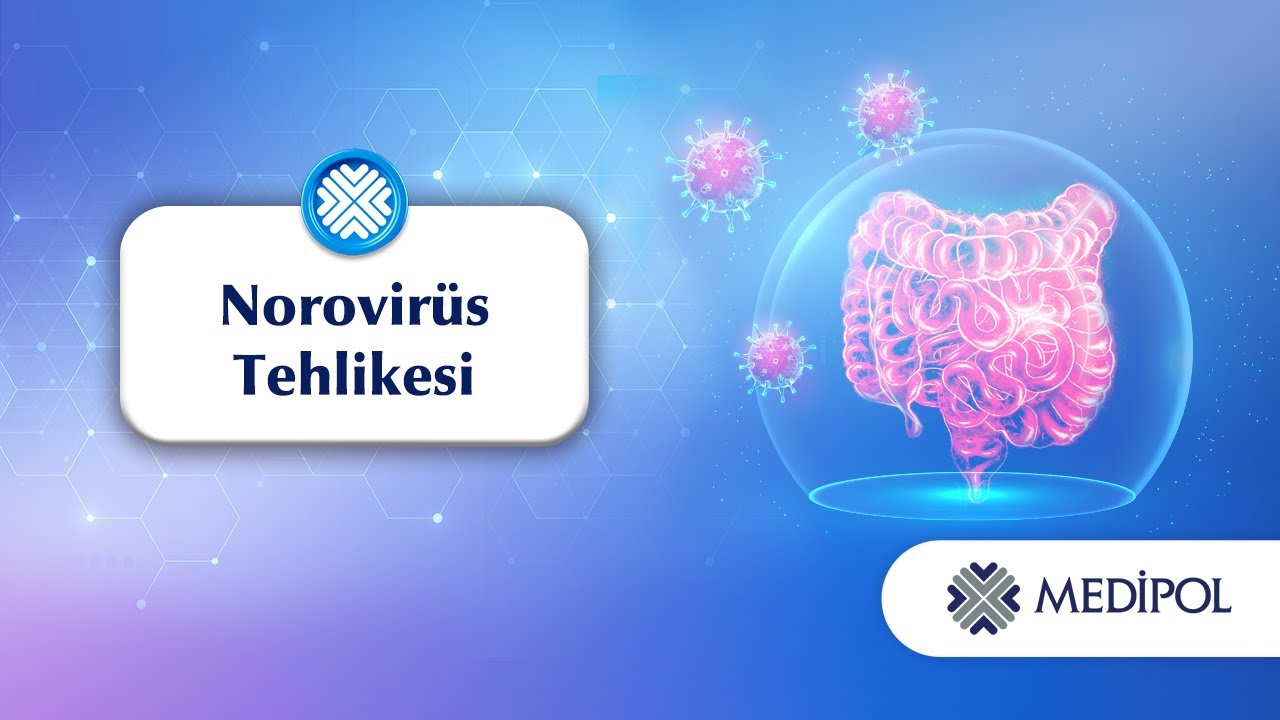 Bulantı ve Kusmayla Ortaya Çıkan Norovirüs Nedir?