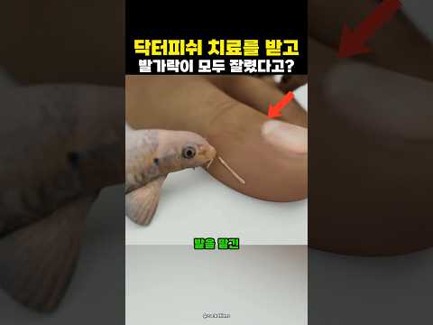 닥터피쉬 치료를 함부로 받으면 안되는 이유?