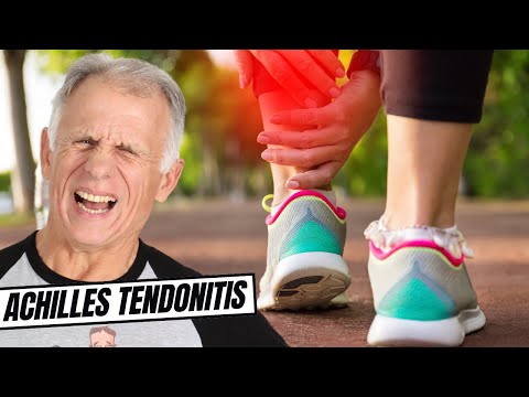 Achilles Tendonitis: Absolute Best Self-Treatment