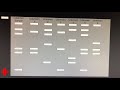 DNA Analysis and Gel Electrophoresis