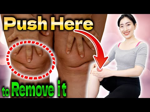 Pushing Here to Drain Knee Lymph Nodes Removes Knee Fat & Pain and Slims Legs