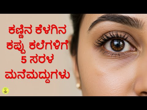 ಕಣ್ಣಿನ ಕೆಳಗಿನ ಕಪ್ಪು ಕಲೆಗಳಿಗೆ 5 ಸರಳ ಮನೆಮದ್ದುಗಳು | Dark Circles Home Remedies in Kannada