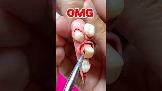 Putting TEETH 🦷 On Her NAILS?🤢💅🏻😱 #nails #summerween #nailart
