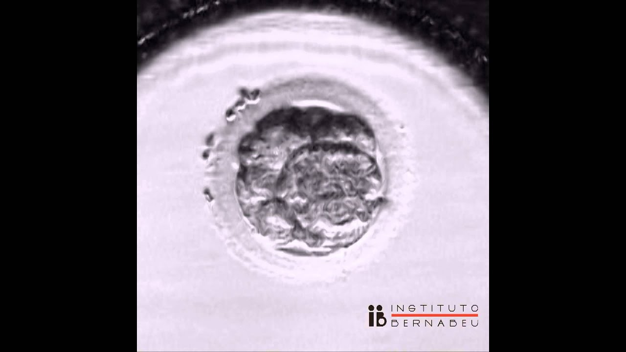División embrionaria hasta blastocisto. Time Lapse del Instituto Bernabeu