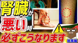 【危険】知らないと後悔する。足・皮ふ・目..「腎臓」が弱っていると起きる超意外な危険サイン。人工透析を避ける術は。こんな薬が腎不全の引き金を引く？「クレアチニン」とは何か。医師が完全解説【腎臓総集編】