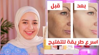 ازاي تفتحي بشرتك بسرعه من اسمرار الشمس - وتعالجي اثار الحبوب صح ؟