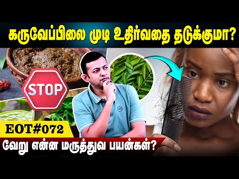 கருவேப்பிலை முடி உதிர்வதை தடுக்குமா? | வேறு என்ன மருத்துவ பயன்கள்? | EOT 072 | Dr. Arunkumar