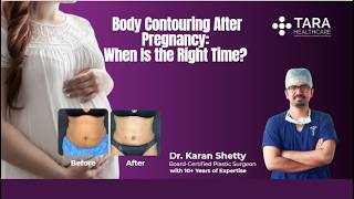 Body Contouring After Pregnancy: When Is the Right Time? | Dr. Karan Shetty