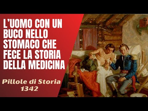 1342- L'uomo con un buco nello stomaco che fece la storia della medicina [Pillole di Storia]