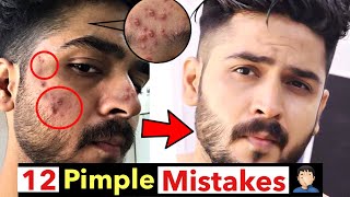 12 Acne Pimple Mistakes | How to Remove Pimples From Face | Remove pimples Naturally
