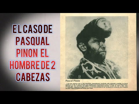 El Caso de Pasqual Pinon – El Hombre de Dos Cabezas