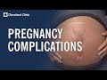Pregnancy Health and Complications