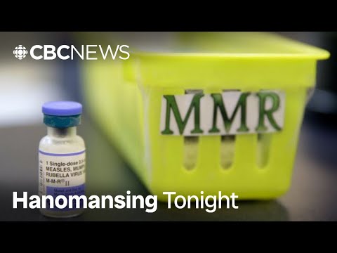 YouTube video thumbnail: Alberta now has More Confirmed Measles Cases Than Entire U.S.