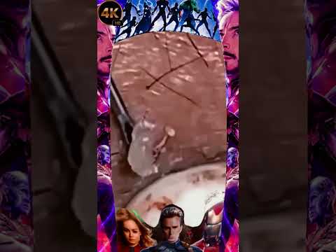 Big Cystic Acne Blackheads Extraction Blackheads & Milia, Whiteheads Removal Pimple Popping