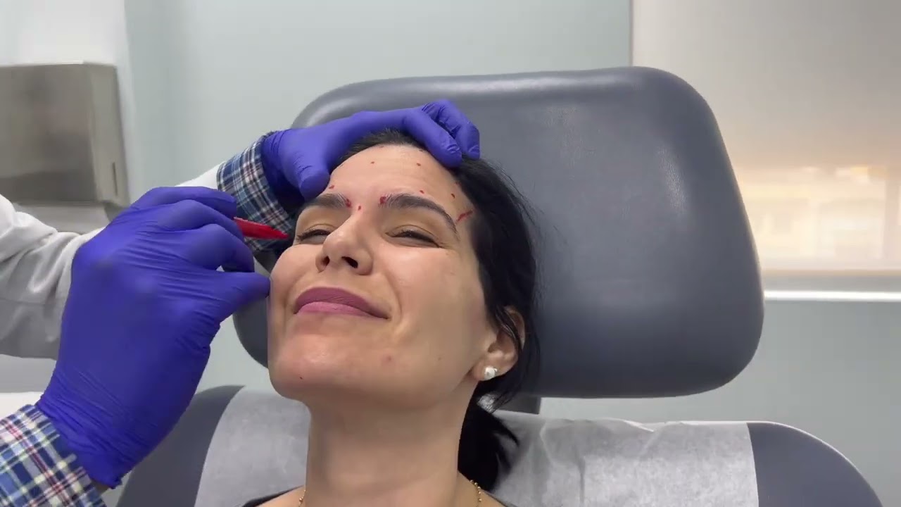 Woman with markings for cosmetic procedure preparation.