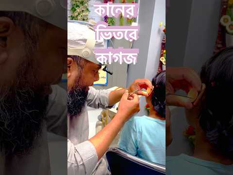 কানের ভেতরে কাগজ #নাক_কান_গলা #viralshort #doctor #shortsbreak #