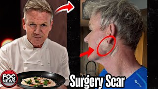 Gordon Ramsay Reveals Skin Cancer Surgery Scar After Treatment