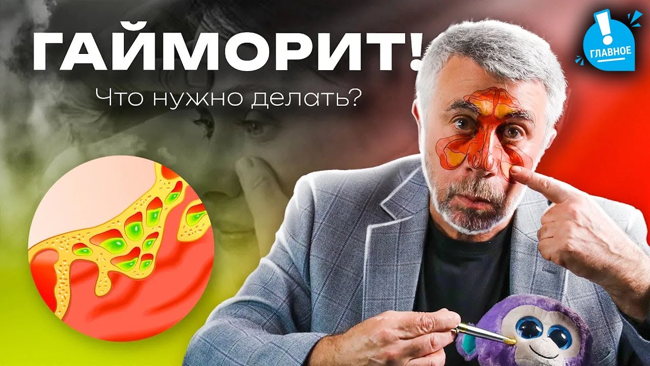Гайморит. Причина имеет значение