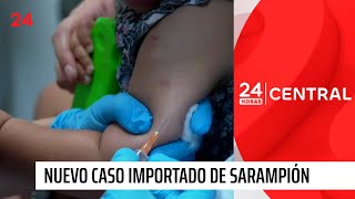 Minsal confirma nuevo caso importado de sarampión