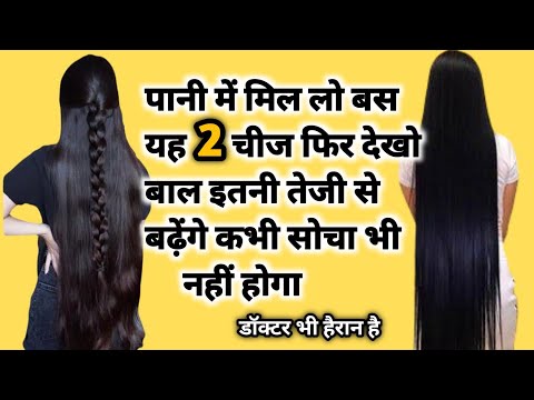 में हैरान रह गई😳,सिर्फ 7 दिन में, बाल इतने बड़े की कटवाने पड़े,10X Longer Hairs