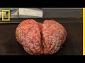 Understanding the Brain Bank and Brain Research