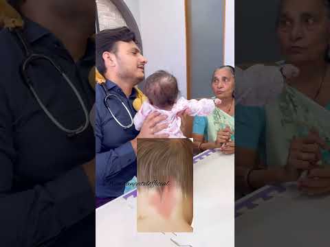Stork bite. #drimranpatel #baby #birthmark