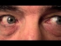Understanding Vestibular Disorders