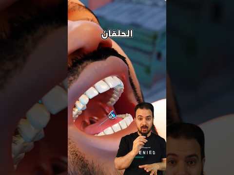 حرامي سرق المجوهرات وبلعها