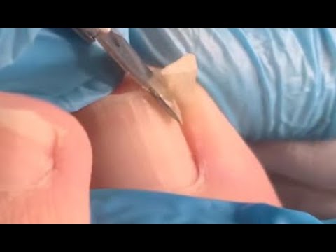 How  to repair nails