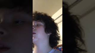 Nerf duel w/ monkey parkour Vlogger (injury)