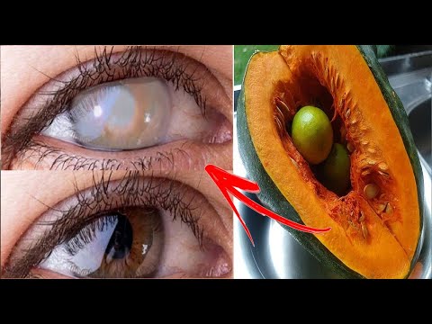 TROQUEI MEU ÓCULOS POR ISSO/ MEU OCULISTA FICOU LOUCO QUANDO VIU MEUS EXAMES..