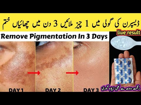 Disprin Tablet for Skin pigmentation and anti acne | Get Beautiful, soft, spotless and glowing skin