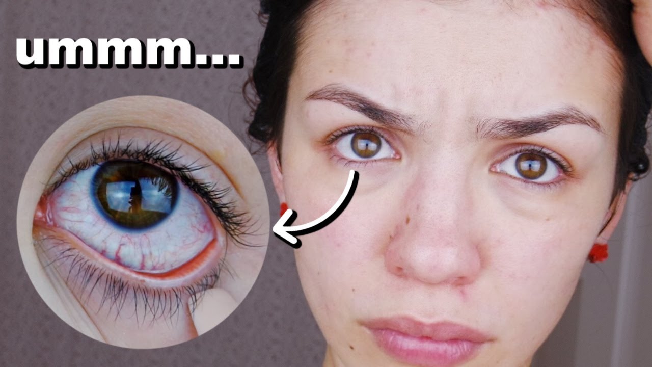 I used kylie skin everyday for 7 days and this is what happened - Audrey Victoria