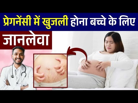 प्रेगनेंसी में खुजली बच्चे के लिए जानलेवा | Pregnancy me Khujli Kyu Hoti hai | Itching in Pregnancy