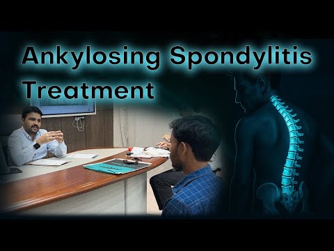 Ankylosing spondylitis treatment | Dr. Harish Grover