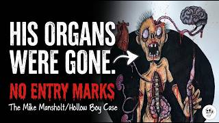The HOLLOW Boy of MALTA: The Case of MIKE MANSHOLT || Taking Organs ILLUSTRATION