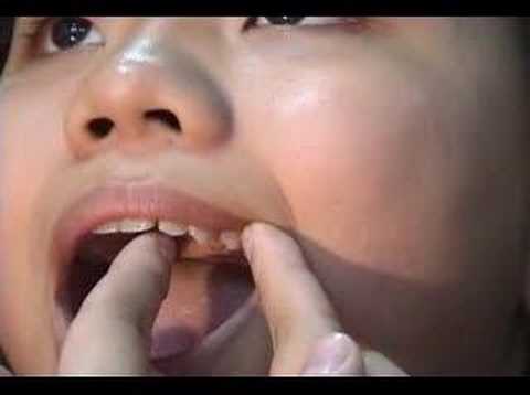 牙線示範教學 
