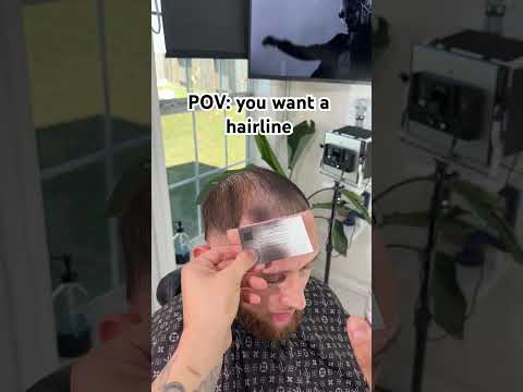POV you want a hairline #trending #baldingsolution #barber